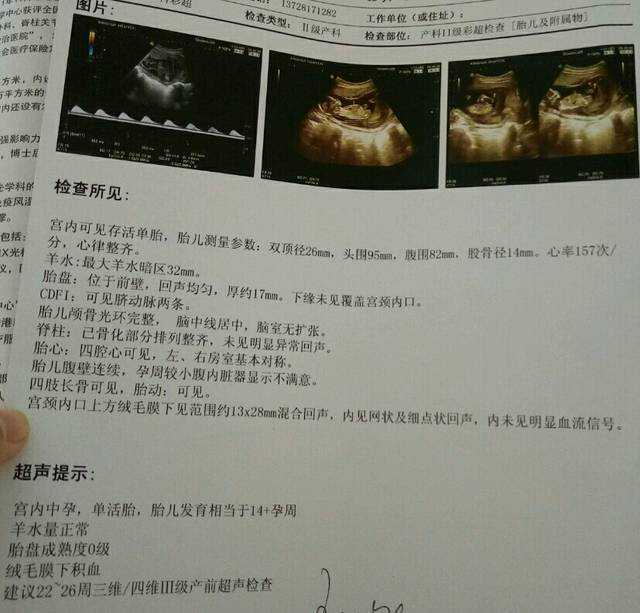 天津国内助孕咨询,天津三代试管包生儿子多少钱？附生男孩费用明细一览！